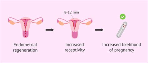 endometrial scratch meaning